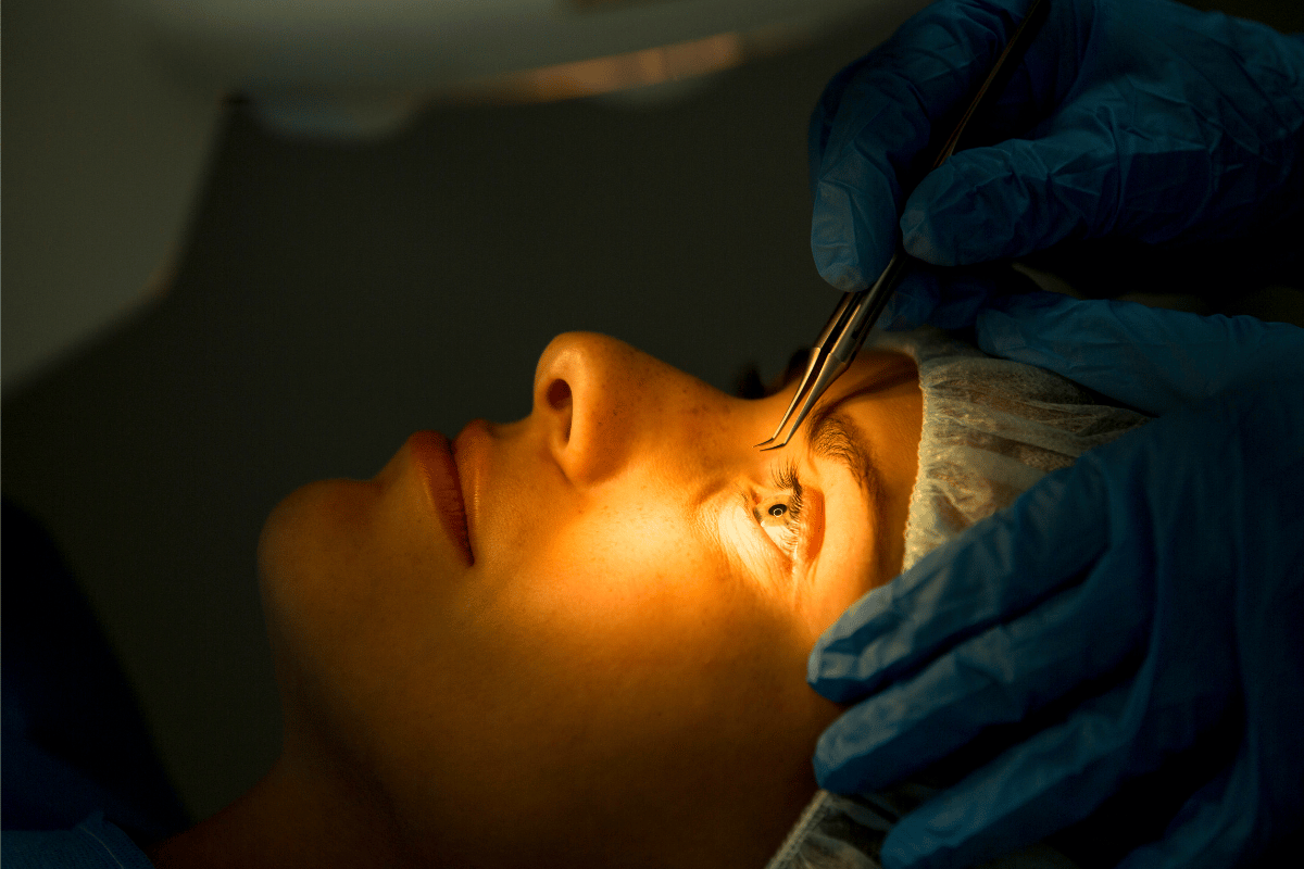 Close-up of a person's eye during a medical procedure with tweezers