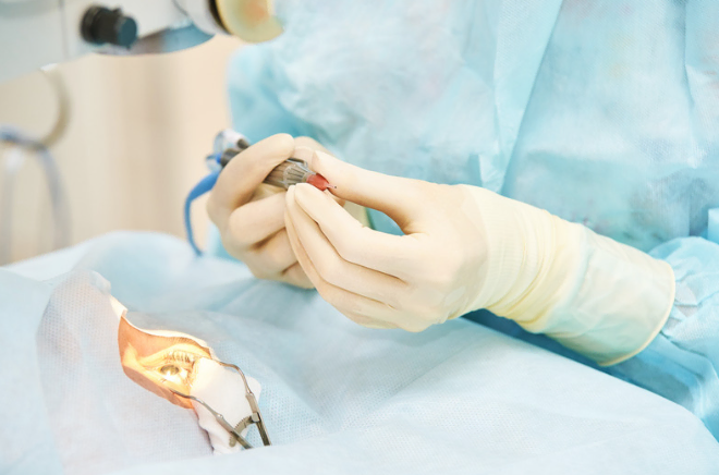 Close-up of a surgeon's gloved hands performing eye surgery on a patient.